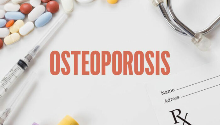 Ten steps to avoid or reverse osteoporosis